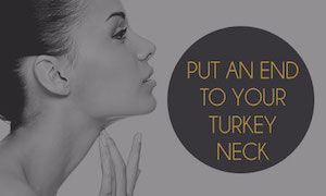 Putting An End To Your Neck Folds & Wrinkles With A Neck Lift
