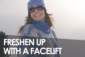 freshen up with a facelift